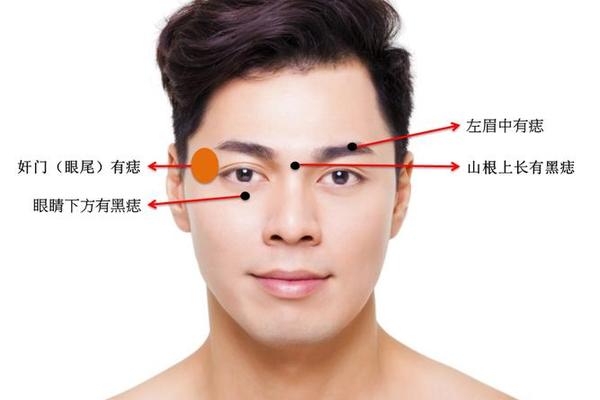 左眼角有颗痣是淫相吗—眼角有三颗痣这代表着什么 左眼角有颗痣是淫相吗—眼角有三颗痣这代表着什么