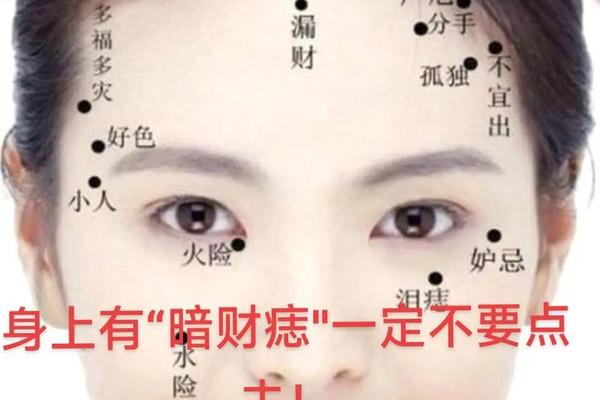 脸上巨富痣的痣相 身上5个巨富痣