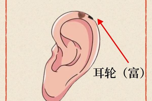 痣相算命命运口诀图解;耳朵有痣的命运 图解