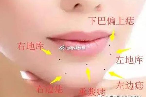 下巴痣相长出毛图解女人-女人下巴有痣还带几根毛