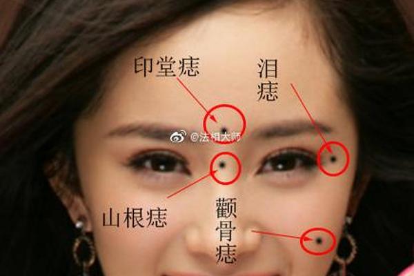 长在颧骨上面的痣相(颧骨上的痣是什么痣)