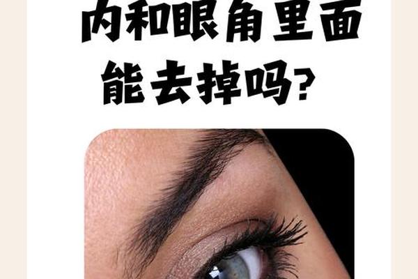 女人眼白有痣相;眼白有个黑痣代表什么