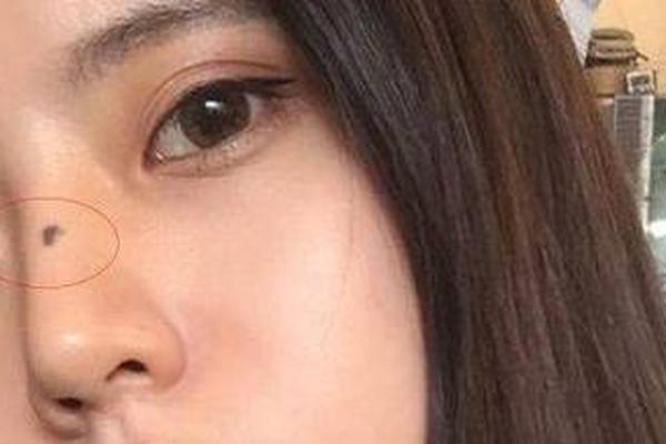 右滕盖上的痣相(右膝盖有痣的女人图解)