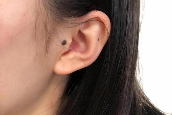 女人耳朵有痣相_耳朵哪里的痣有福气图
