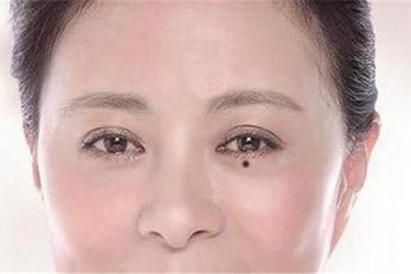 哭夫痣旺夫相吗-女人有哭夫痣代表什么