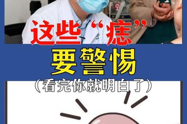 痣相大的不如小的好,天生的痣和后天的痣区别