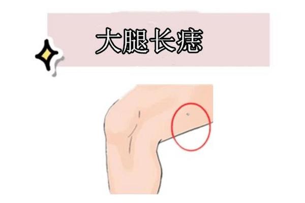 大腿根有痣命运图 痣相、大腿后面有痣图解