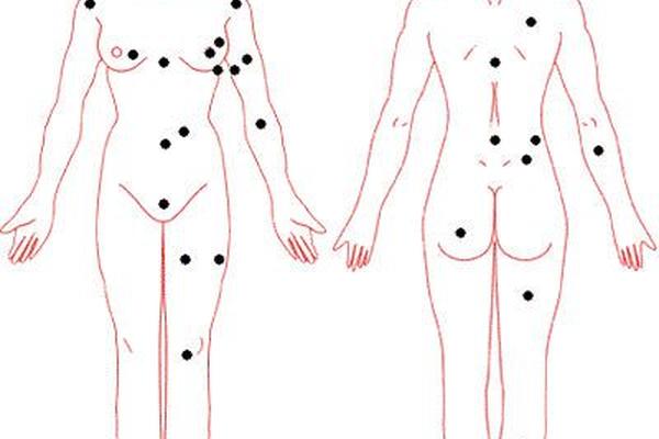 女子全身痣相大全,全身痣相图片大全图解