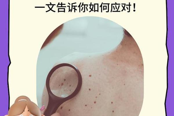 女相后背中间有痣 女人后背正中间有痣代表什么