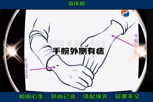 男人右手腕痣相;男人右手腕上有痣图解