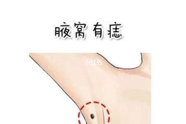 左腋窝附近痣相 腋窝长痣左边女的