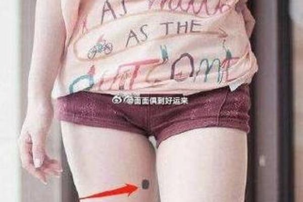 右大腿内痣相 右大腿内侧有痣