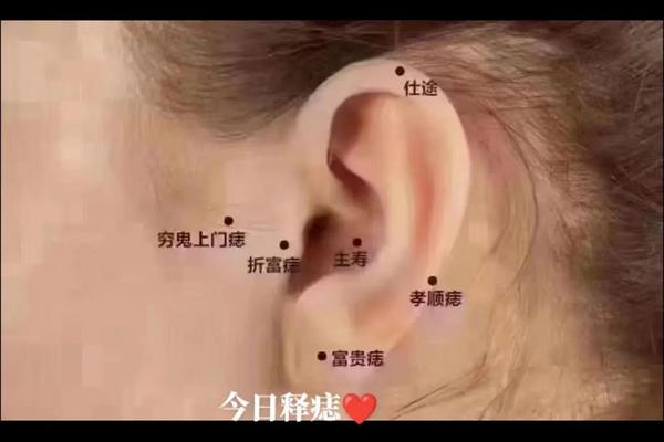 有克夫痣相的女人好不好、女人耳朵上的痣图解