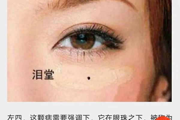 眼睛下方的痣是什么痣相—眼睛下方有个痣