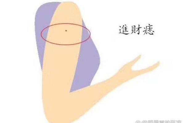手臂巨富的痣相-手臂有痣代表什么