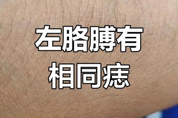 左手小臂痣相影响贵人、女人手臂有痣图解
