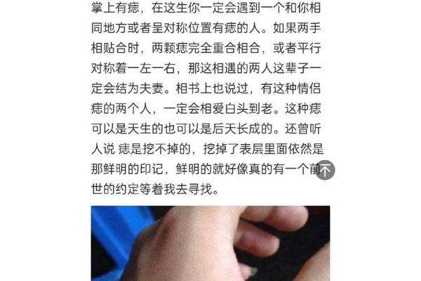 手背部痣相 手上痣相图解大全 手背部痣相 手上痣相图解大全