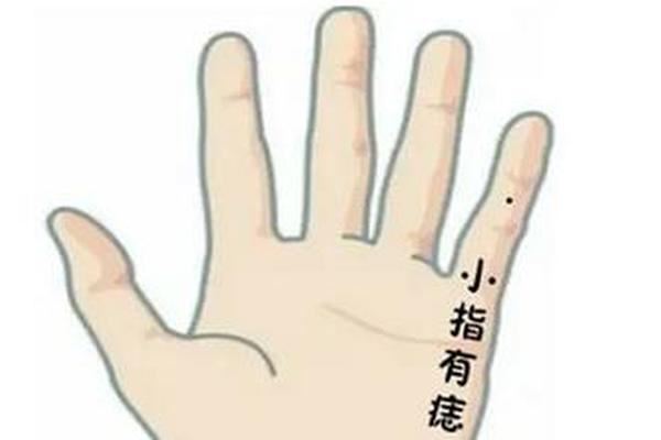小拇指关节痣相(小拇手指长痣图解)