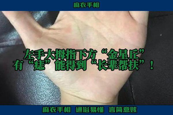 女左手金星丘痣痣相—金星丘最近长出了痣