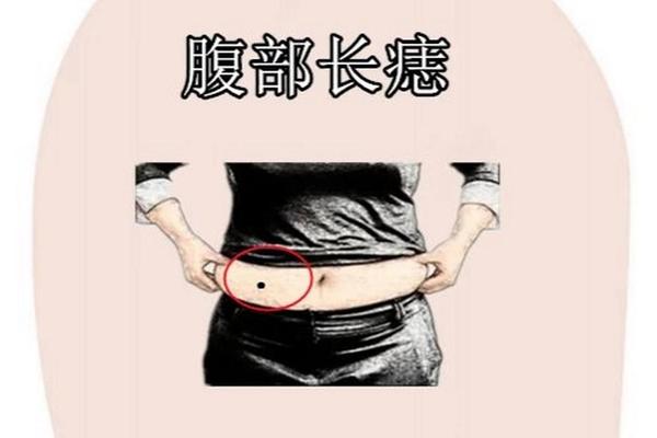 腹部左侧长痣相、肚子左侧长痣代表什么意思 腹部左侧长痣相、肚子左侧长痣代表什么意思