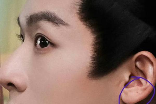 男人耳痣相,男人耳屏痣的正确位置图片