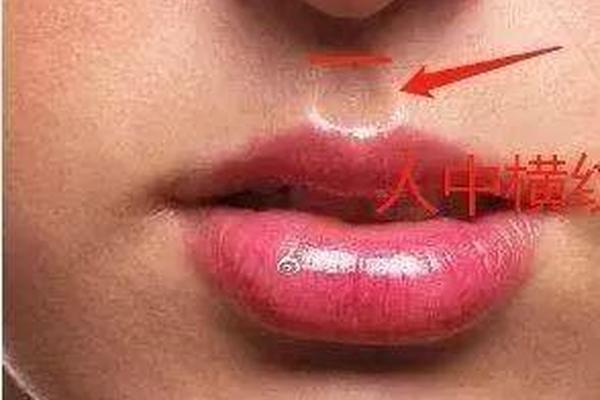 痣相两眉间红色—眉间突然出现红色竖纹