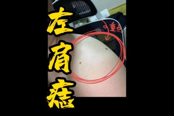 男人肩膀上有痣的图相(男人左肩有痣代表什么)