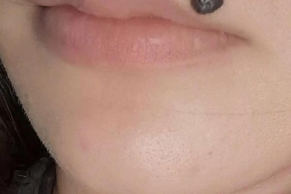 女相脸长嘴角痣好不好看—脸上嘴角有痣好不好