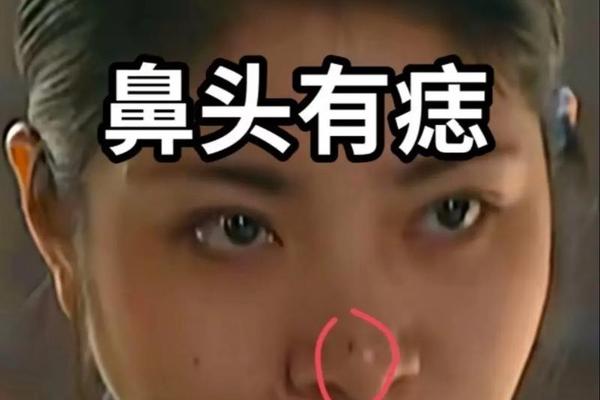 女相鼻梁下右侧有痣_鼻梁右侧有痣的女人面相