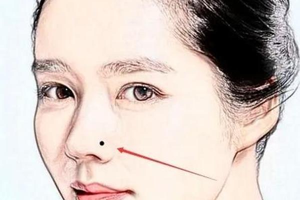 女相鼻翼有痣-鼻翼上方有痣代表什么