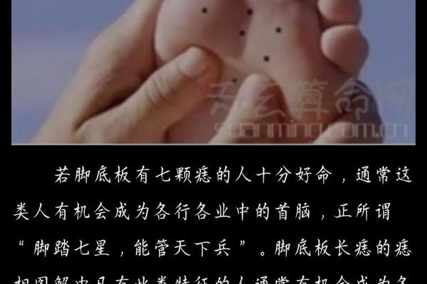 脚长痣的痣相_脚面长痣的位置图解