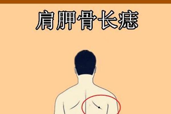 男人后背右边痣相最准图、背部长痣图解大全