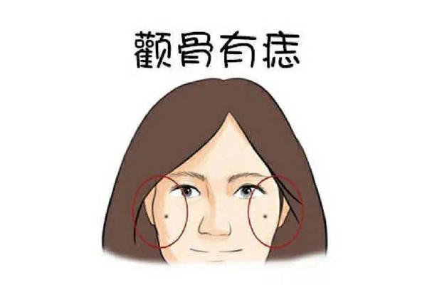 女人左颧骨有痣相;右脸颧骨有痣的女人面相 女人左颧骨有痣相;右脸颧骨有痣的女人面相