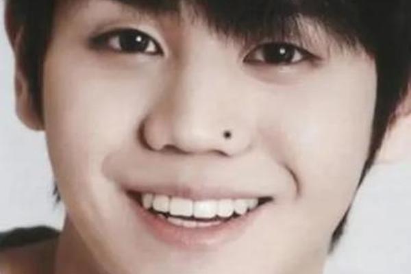 脸颊痣相男侧脸 侧脸脸颊肉特别多图片