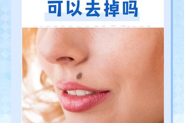 痣毛相法,痣上长毛叫一毛孤三毛富吗