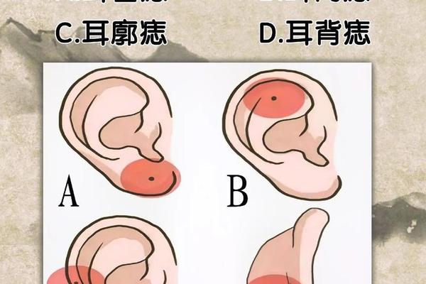 人耳朵长痣富贵相 长痣的位置和命运 人耳朵长痣富贵相 长痣的位置和命运