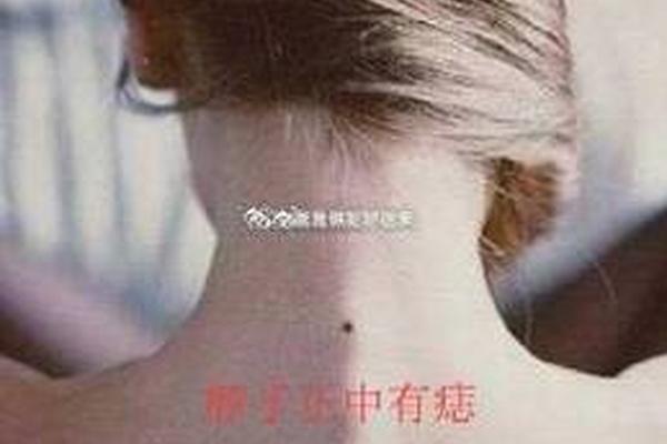 脖子锁痣相—女左侧脖子凶痣的化解方法
