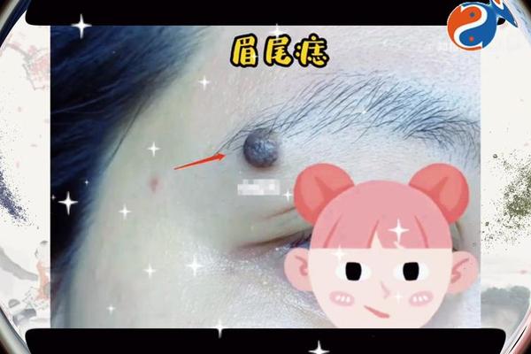 眉毛尾有痣相 左边眉毛尾有痣好不好 眉毛尾有痣相 左边眉毛尾有痣好不好