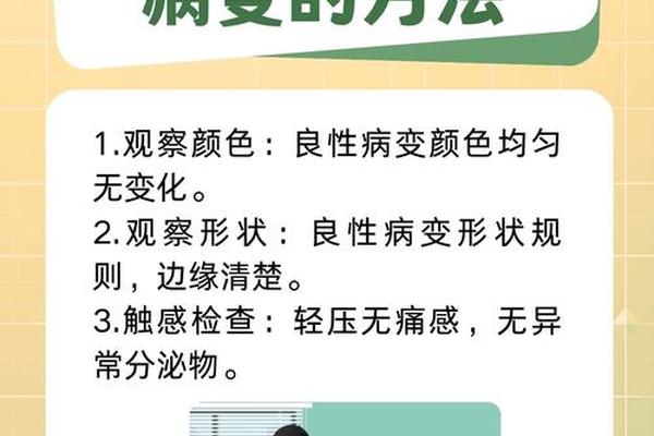 舌头长痣痣相(舌头长痣从命学解释)