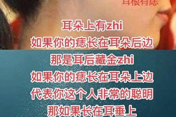 右耳朵前痣相,右耳朵上的痣图解大全 右耳朵前痣相,右耳朵上的痣图解大全