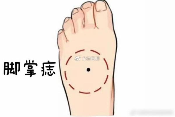 脚踏七星痣相(身上长七星痣的人)