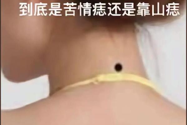 脖子上痣相最准图_颈后痣的位置与命运图