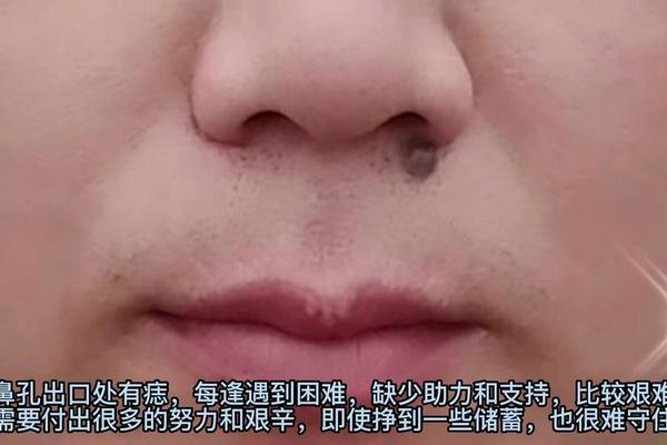 鼻孔痦子长毛了痣相_鼻孔口有痣
