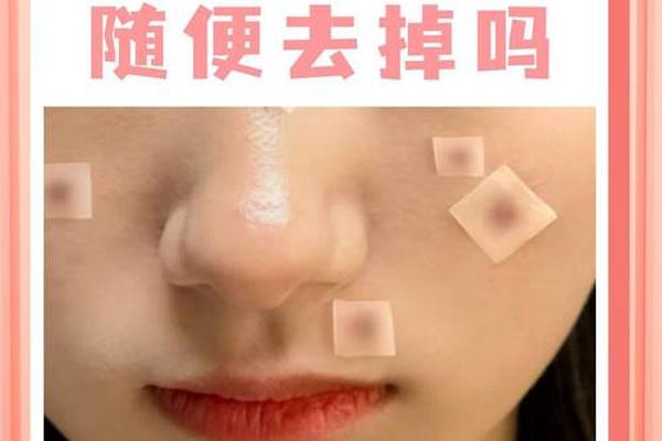 脸上败相的痣能去掉吗女 脸上的痣能随便去掉吗