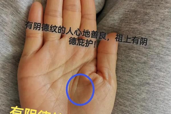 掌相月丘有痣、月丘长痣是积阴德吗