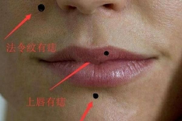 嘴边痣相-嘴角的痣叫什么