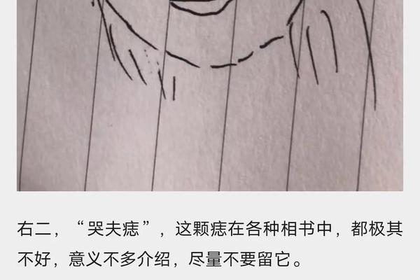 痣相泪猴、什么是眼泪痣 痣相泪猴、什么是眼泪痣