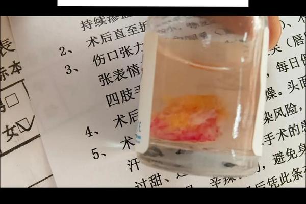 相城医院点痣多少钱一颗-医院激光点痣多少钱