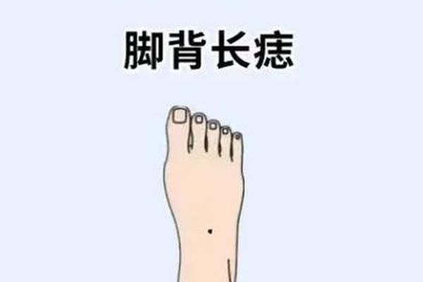 脚指痣相 脚背上面有痣图解 脚指痣相 脚背上面有痣图解