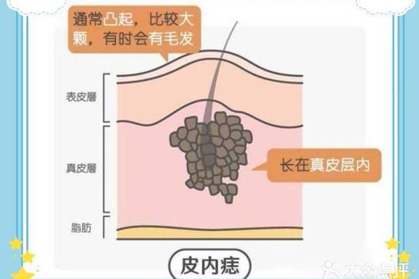 相桥街道祛痣店地址查询—附近祛痣的地方